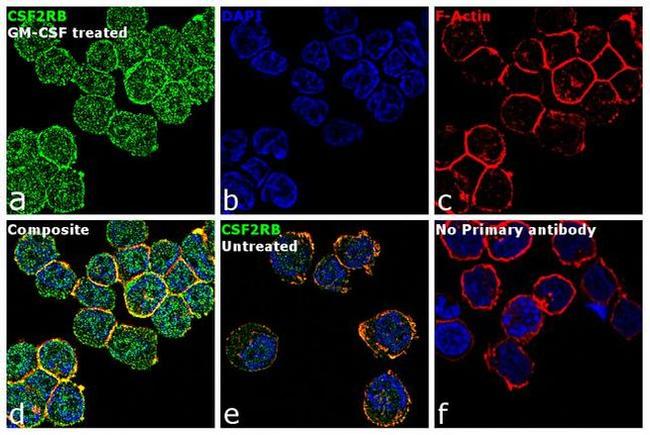 CSF2RB Antibody