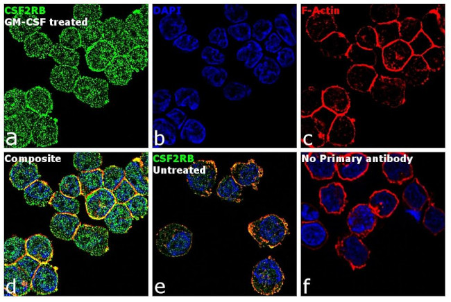 CSF2RB Antibody in Immunocytochemistry (ICC/IF)