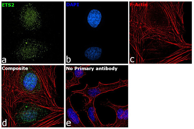 ETS2 Antibody in Immunocytochemistry (ICC/IF)