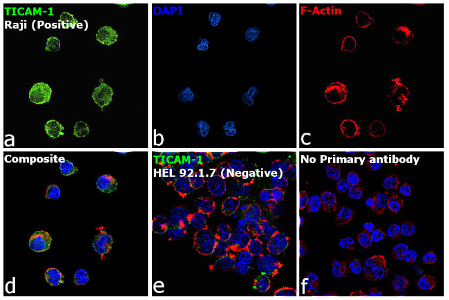 TRIF Antibody in Immunocytochemistry (ICC/IF)