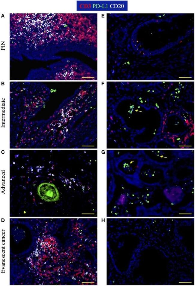 PD-L1 Antibody in Immunohistochemistry (IHC)