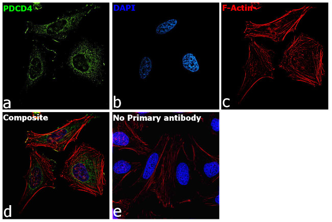 PDCD4 Antibody in Immunocytochemistry (ICC/IF)