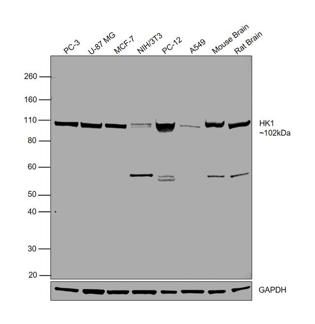 HK1 Antibody in Western Blot (WB)