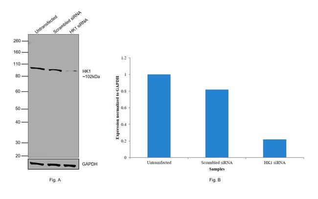 HK1 Antibody in Western Blot (WB)