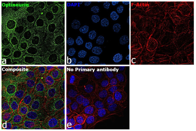 Optineurin Antibody in Immunocytochemistry (ICC/IF)