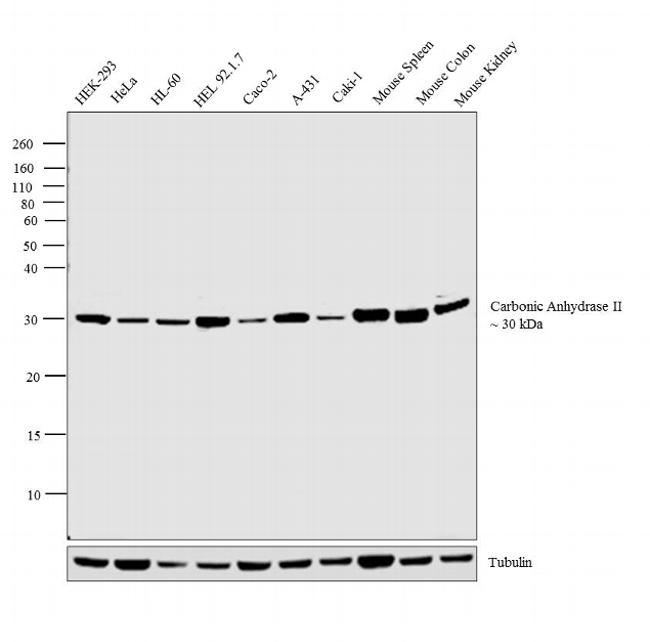 Carbonic Anhydrase II Antibody in Western Blot (WB)