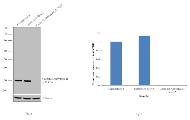 Carbonic Anhydrase II Antibody