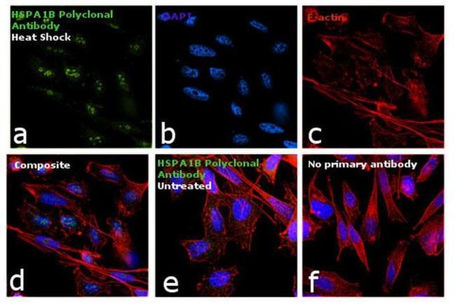 HSPA1B Antibody