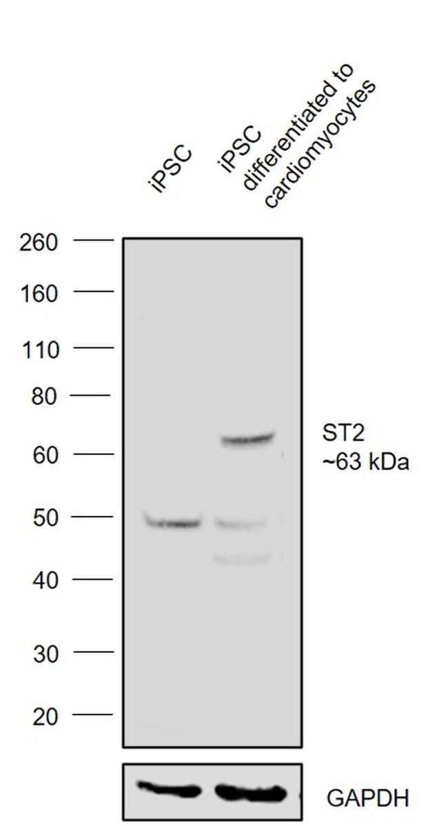 ST2 Antibody in Western Blot (WB)