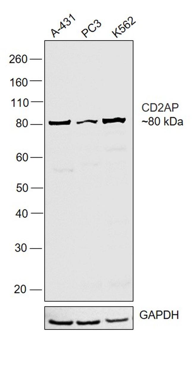 CD2AP Antibody in Western Blot (WB)