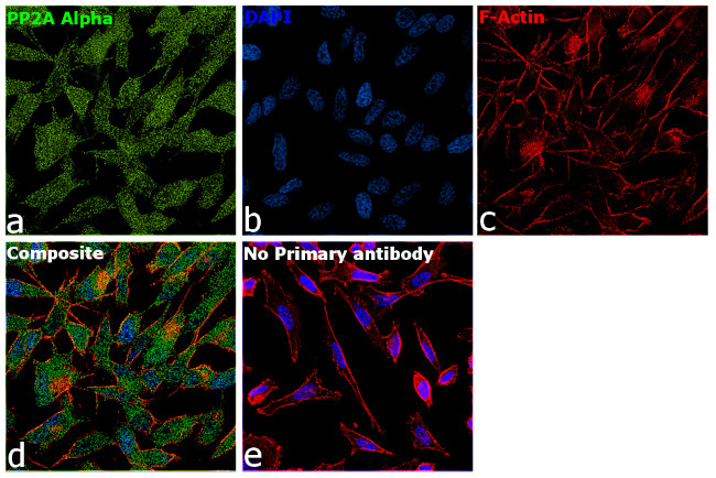 PP2A alpha Antibody in Immunocytochemistry (ICC/IF)