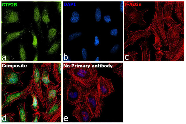 GTF2B Antibody in Immunocytochemistry (ICC/IF)