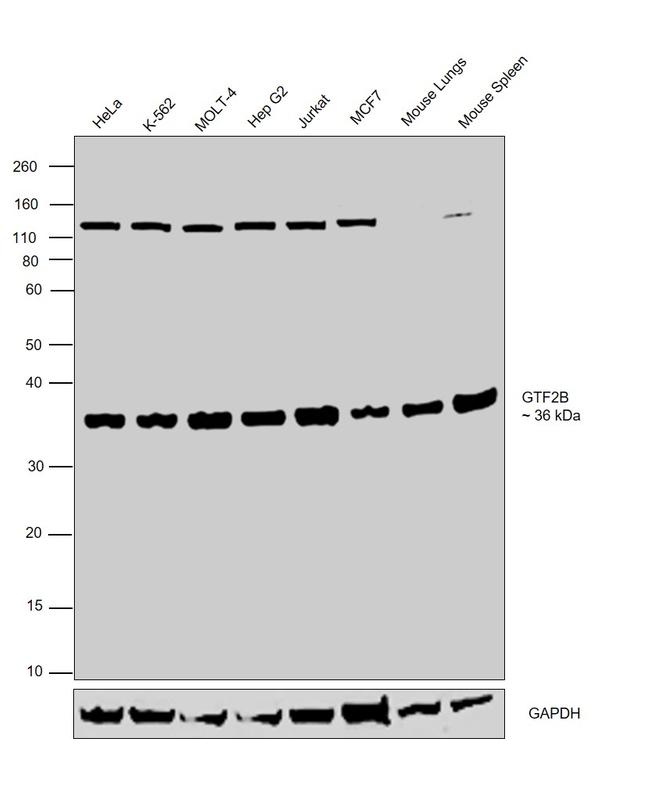 GTF2B Antibody in Western Blot (WB)