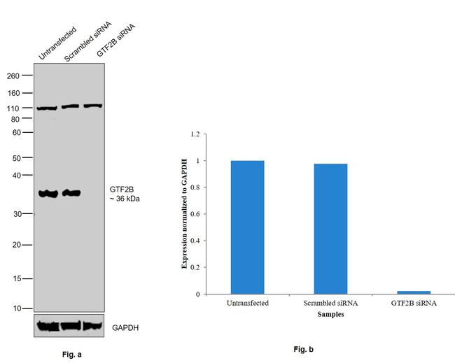 GTF2B Antibody in Western Blot (WB)