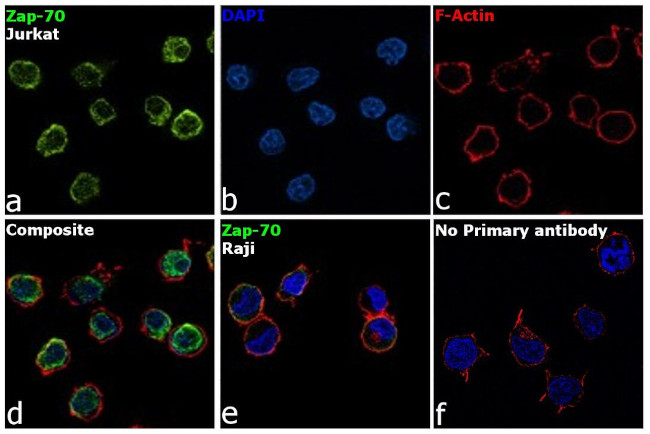 Zap-70 Antibody in Immunocytochemistry (ICC/IF)