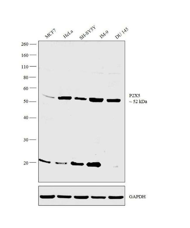 P2X5 Antibody in Western Blot (WB)