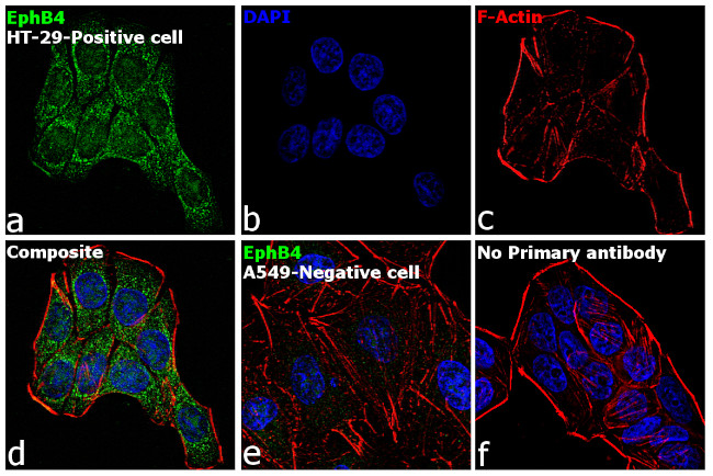 EphB4 Antibody in Immunocytochemistry (ICC/IF)