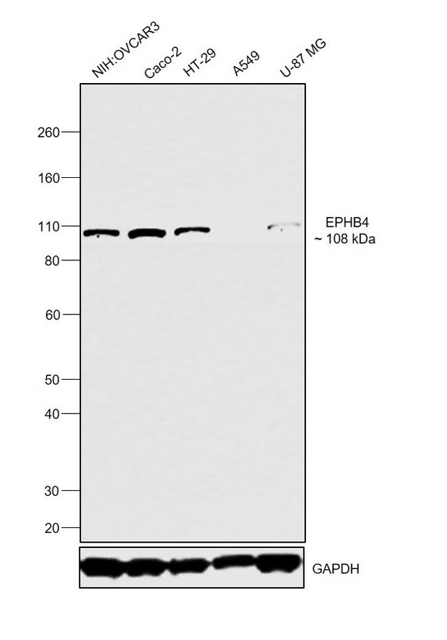 EphB4 Antibody in Western Blot (WB)