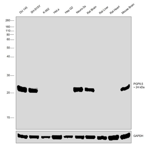 PGP9.5 Antibody in Western Blot (WB)