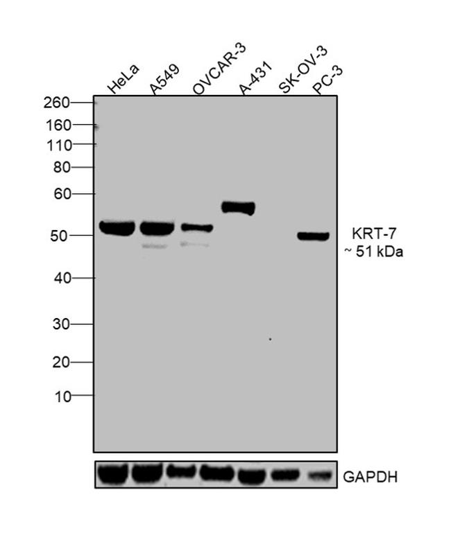 Cytokeratin 7 Antibody in Western Blot (WB)