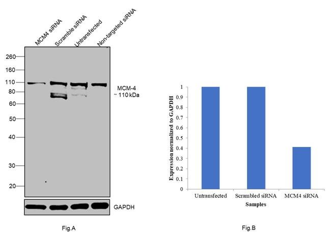 MCM4 Antibody in Western Blot (WB)