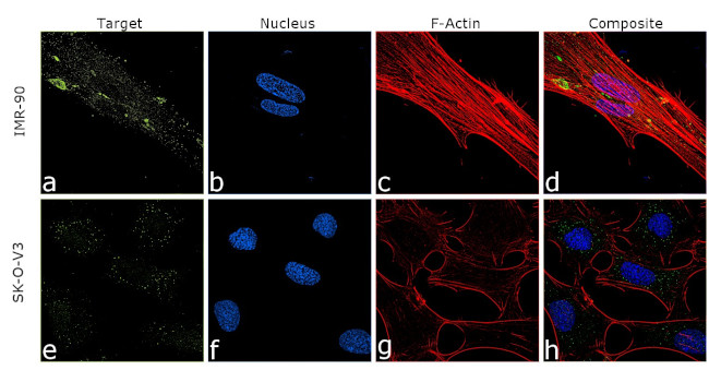 COL6A1 Antibody in Immunocytochemistry (ICC/IF)