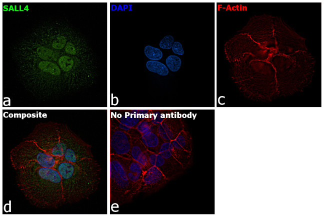 SALL4 Antibody in Immunocytochemistry (ICC/IF)