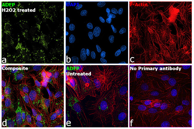 ADFP Antibody in Immunocytochemistry (ICC/IF)