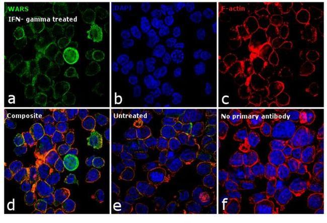 WARS Antibody