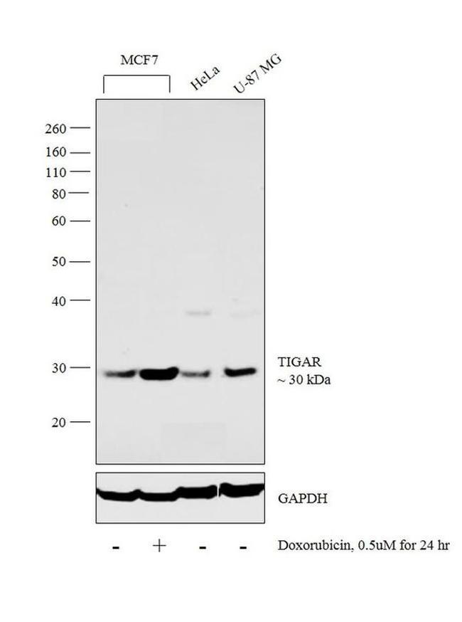 TIGAR Antibody in Western Blot (WB)