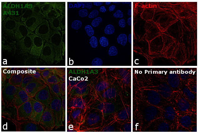 ALDH1A3 Antibody in Immunocytochemistry (ICC/IF)