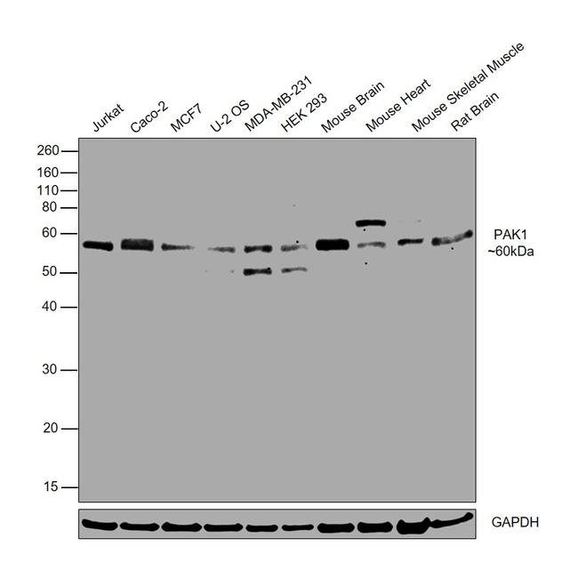 PAK1 Antibody in Western Blot (WB)