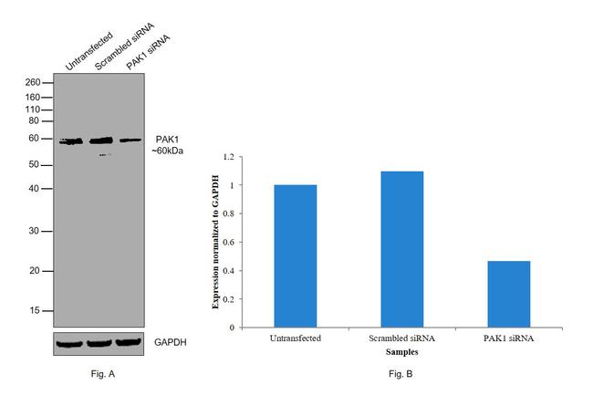 PAK1 Antibody in Western Blot (WB)