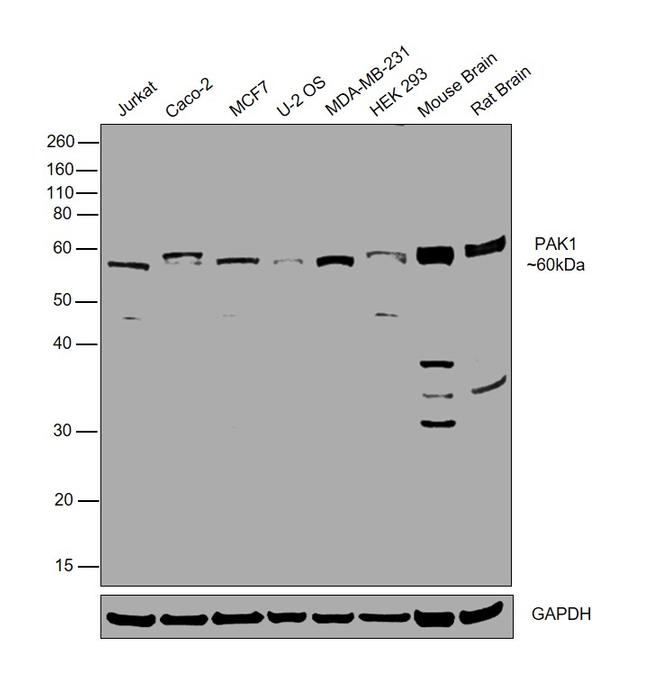 PAK1 Antibody in Western Blot (WB)