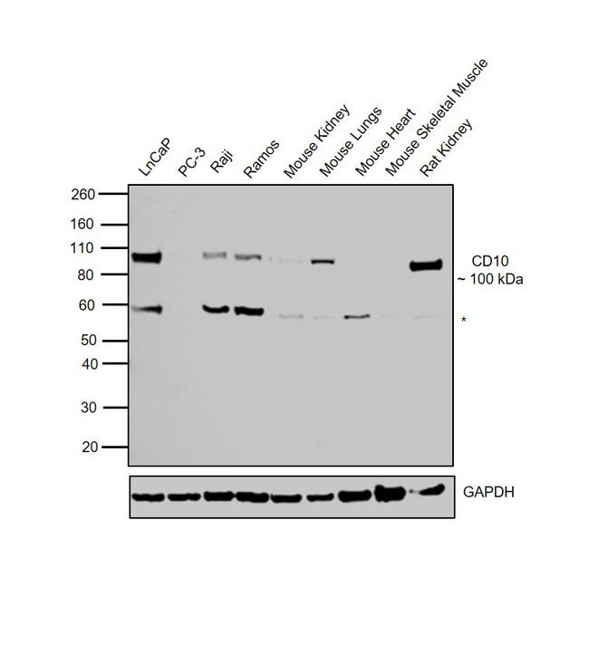 CD10 Antibody in Western Blot (WB)