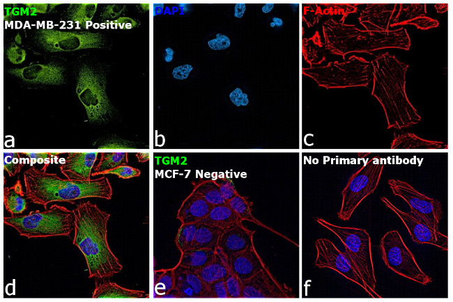 TGM2 Antibody