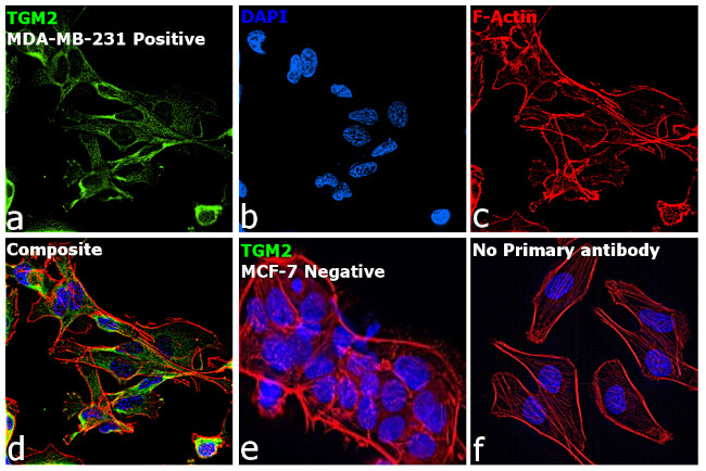 TGM2 Antibody in Immunocytochemistry (ICC/IF)