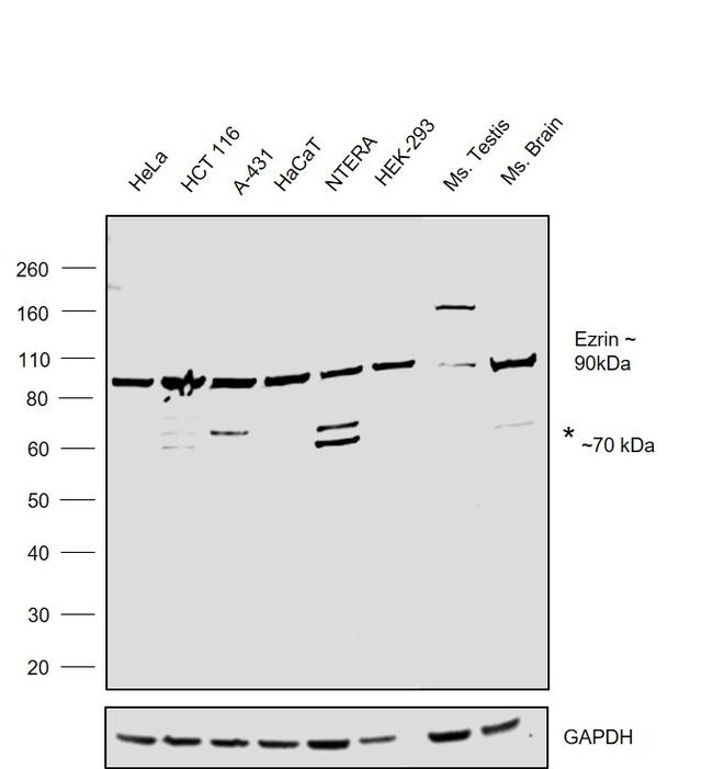 Ezrin Antibody in Western Blot (WB)