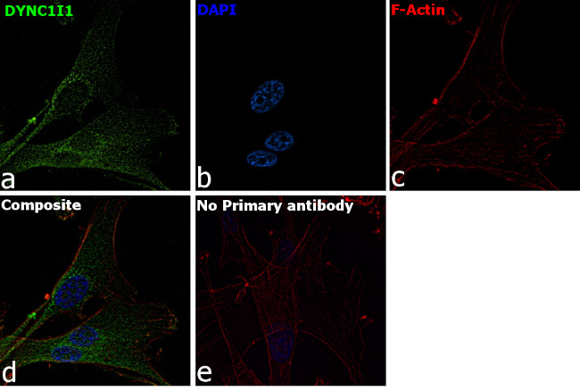 DYNC1I1 Antibody in Immunocytochemistry (ICC/IF)