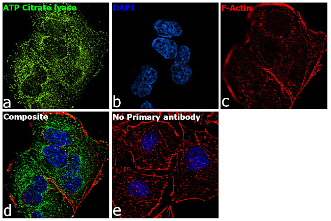 ATP Citrate Lyase Antibody in Immunocytochemistry (ICC/IF)