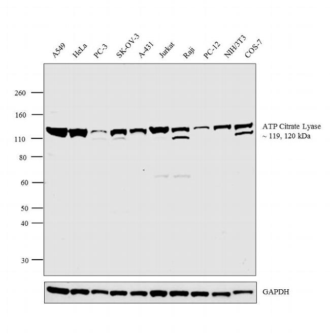 ATP Citrate Lyase Antibody in Western Blot (WB)