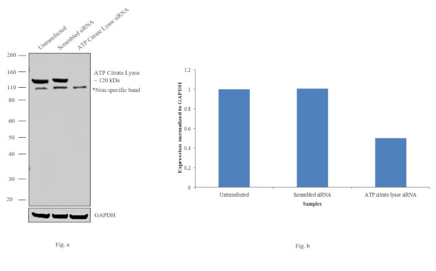 ATP Citrate Lyase Antibody