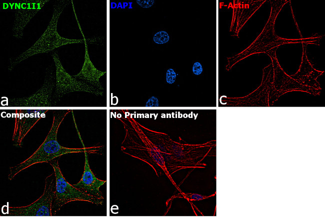 DYNC1I1 Antibody in Immunocytochemistry (ICC/IF)