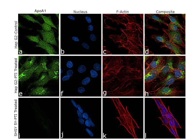 ApoA1 Antibody in Immunocytochemistry (ICC/IF)