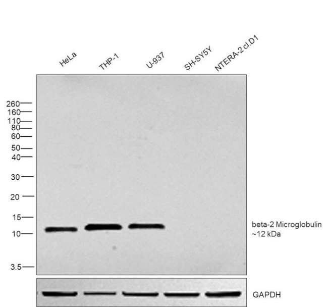 beta-2 Microglobulin Antibody