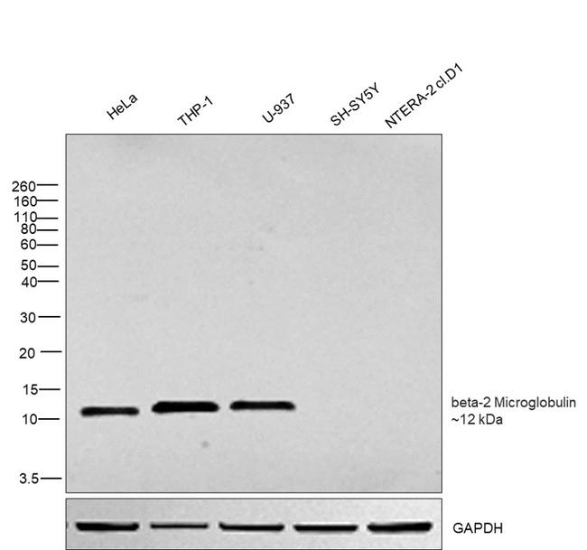 beta-2 Microglobulin Antibody in Western Blot (WB)