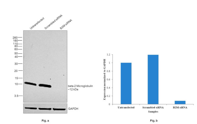 beta-2 Microglobulin Antibody