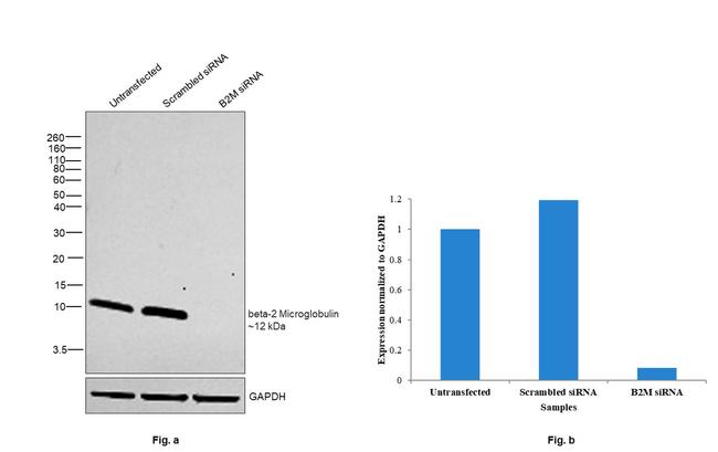 beta-2 Microglobulin Antibody in Western Blot (WB)