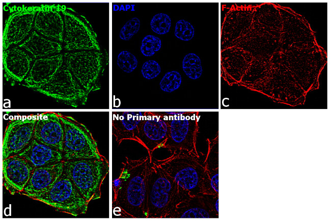 Cytokeratin 19 Antibody in Immunocytochemistry (ICC/IF)