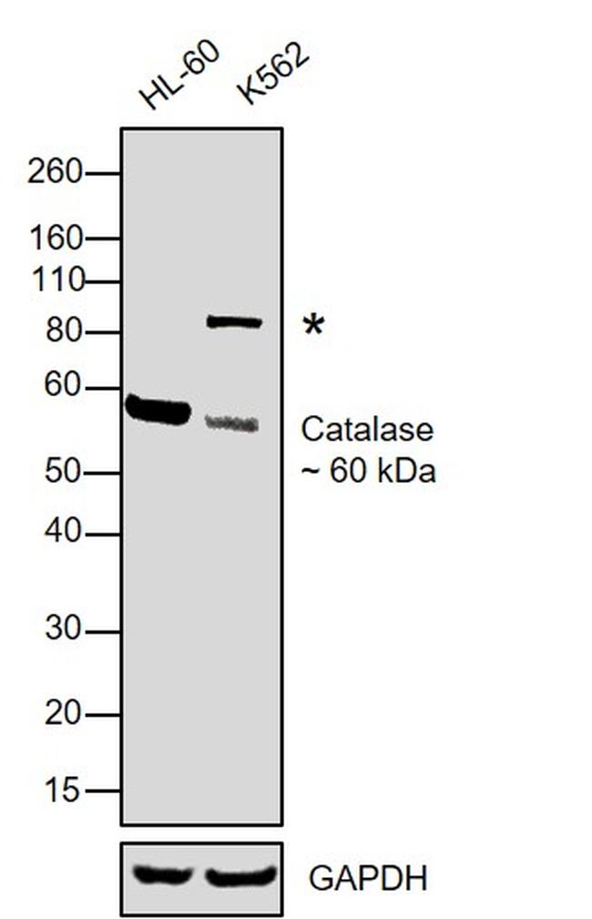 Catalase Antibody in Western Blot (WB)